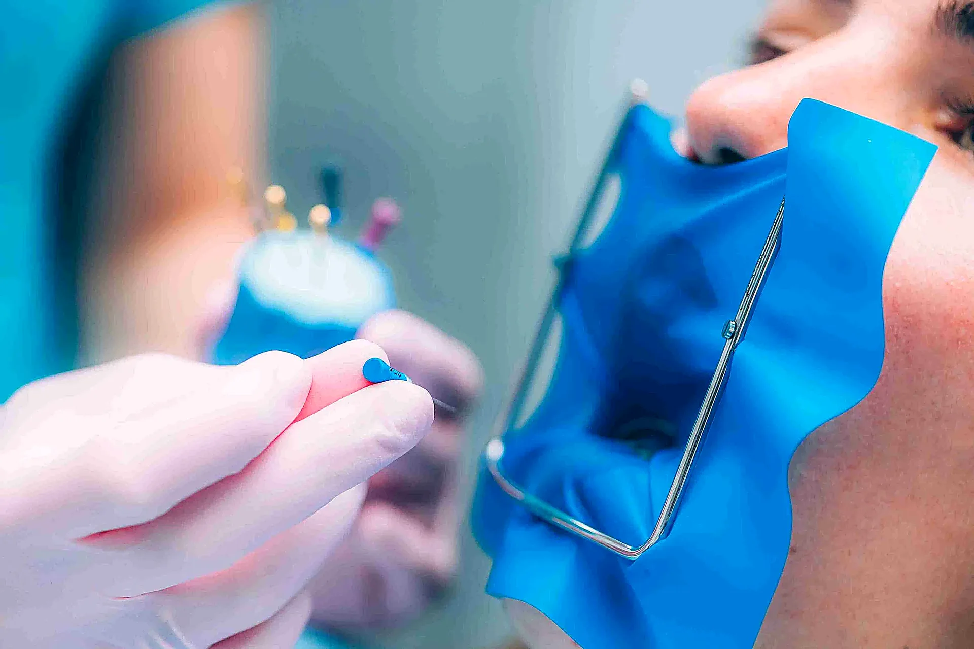 Tratamiento de endodoncia en Dosis Dental