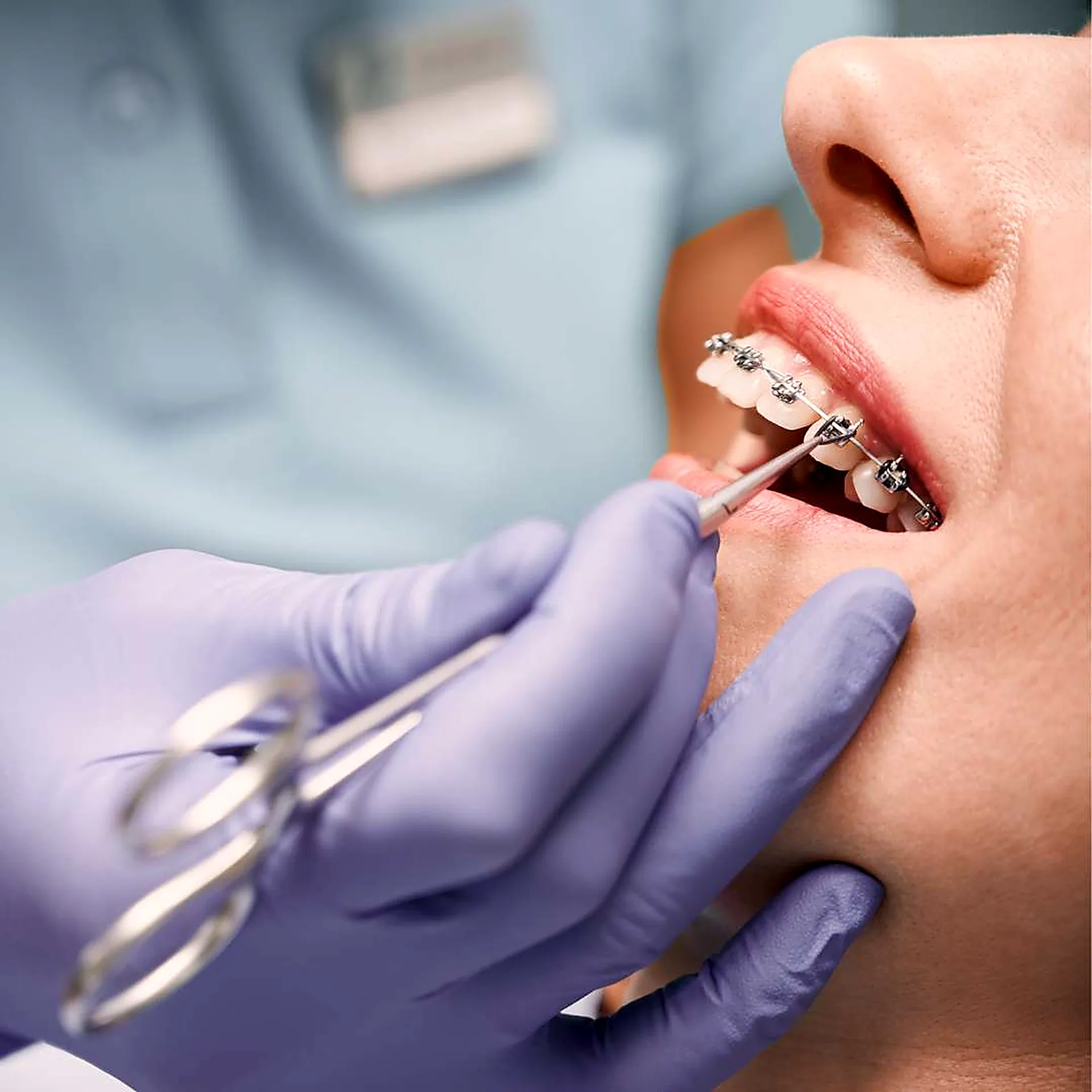 Tratamiento de ortodoncia en Dosis Dental